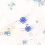 Chlamydosporen von Trichoderma blau eingefärbt und unter dem Mikroskop fotografiert. Quelle Empa.