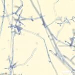 Hyphen und Phialiden von Trichoderma blau eingefärbt und unter dem Mikroskop fotografiert. Quelle Empa.