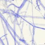 Hyphen von Trichoderma blau eingefärbt und unter dem Mikroskop fotografiert. Quelle Empa.